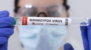 Monkeypox test kits available in Kuwait